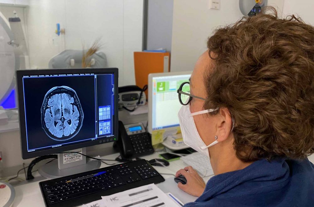 Neurología Ceuta